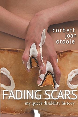 Fading Scars: My Queer Disability History