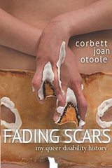 Fading Scars: My Queer Disability History