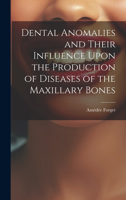 Dental Anomalies and Their Influence Upon the Production of Diseases of the Maxillary Bones - Ingram