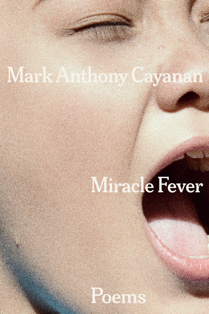 Miracle Fever: Poems